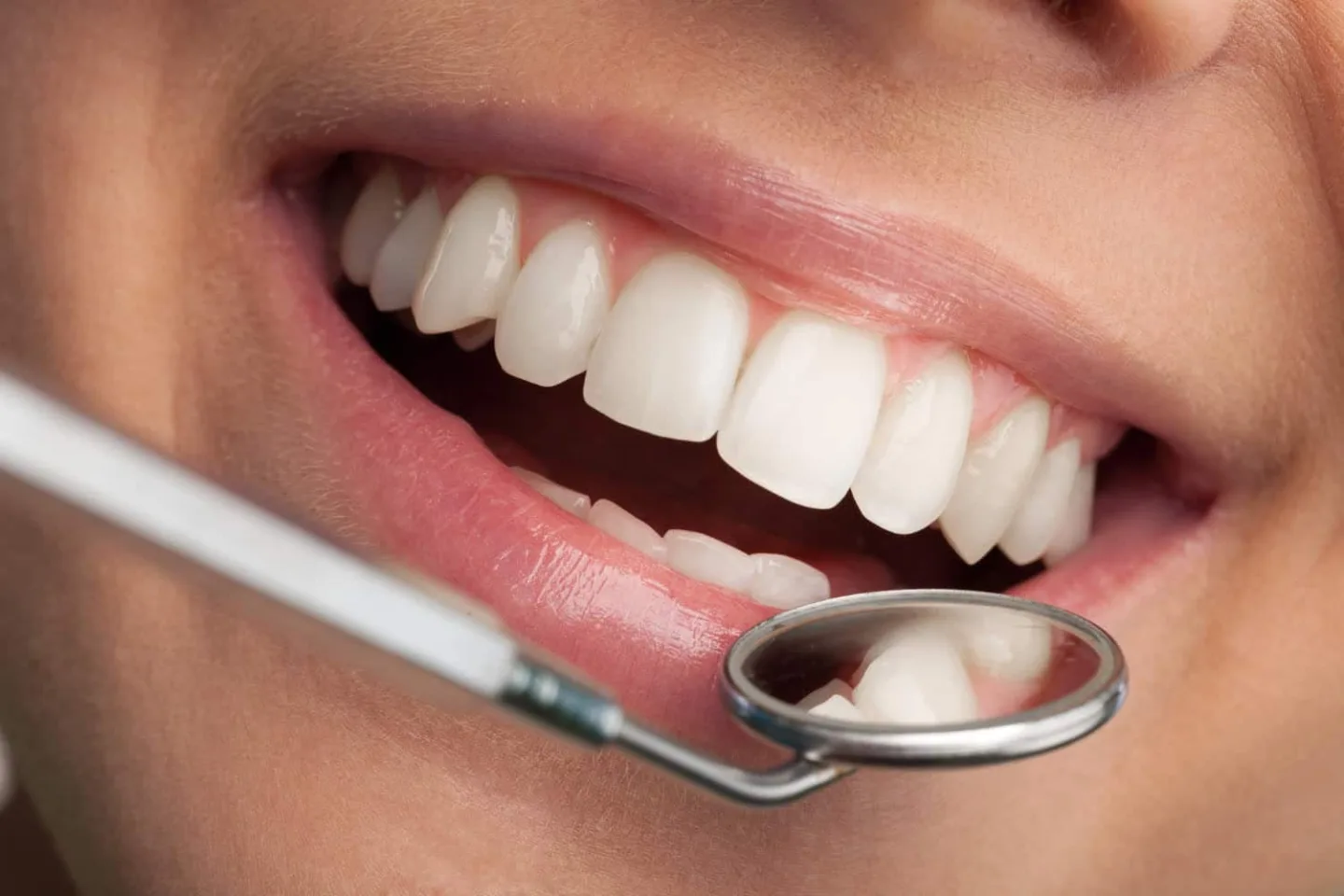 Lo que dice tu salud bucodental sobre tu bienestar general