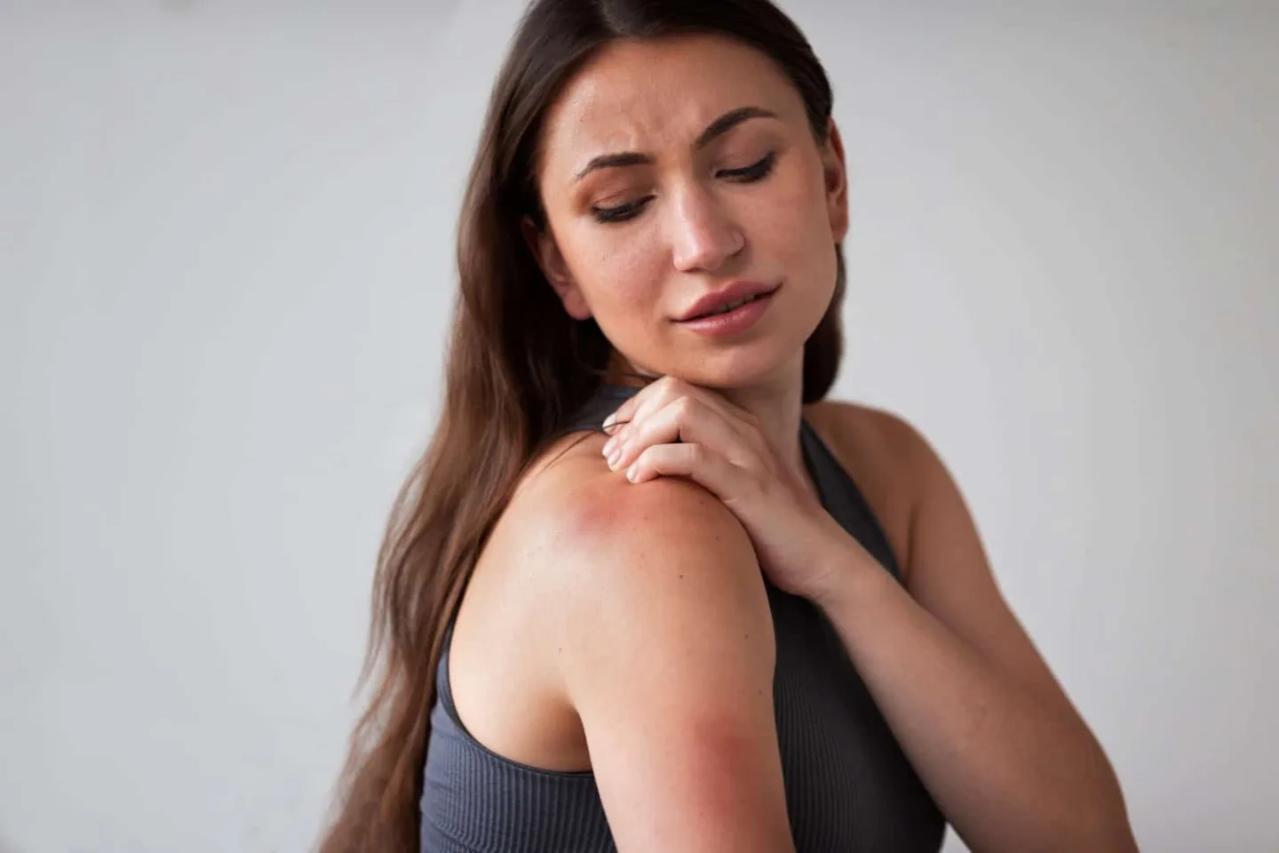 Mujer con alergia - enfermedades autoinmunes