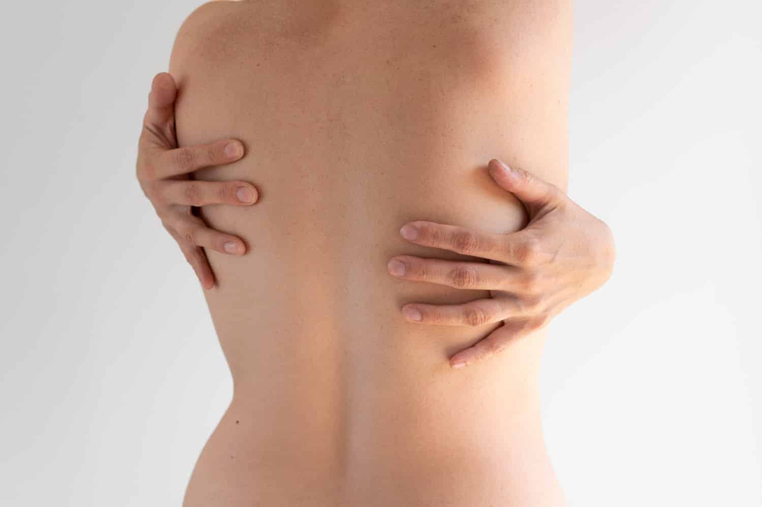 Cómo eliminar eficazmente el acné de la espalda