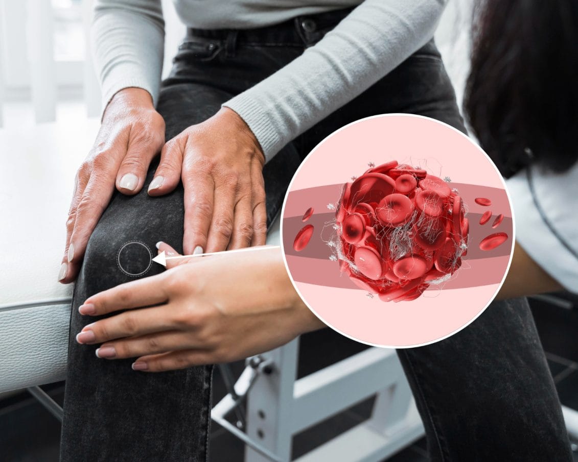 Cómo Combatir La Mala Circulación Y Mejorar Tu Salud