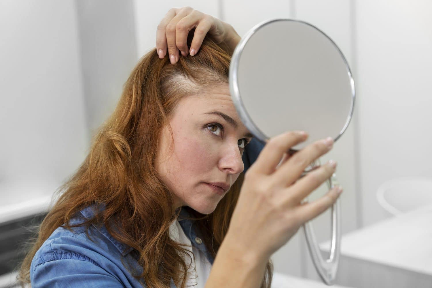 alopecia en mujeres