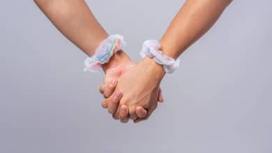 Caso Kessler los juristas analizan los grises del suicidio asistido de las gemelas artistas