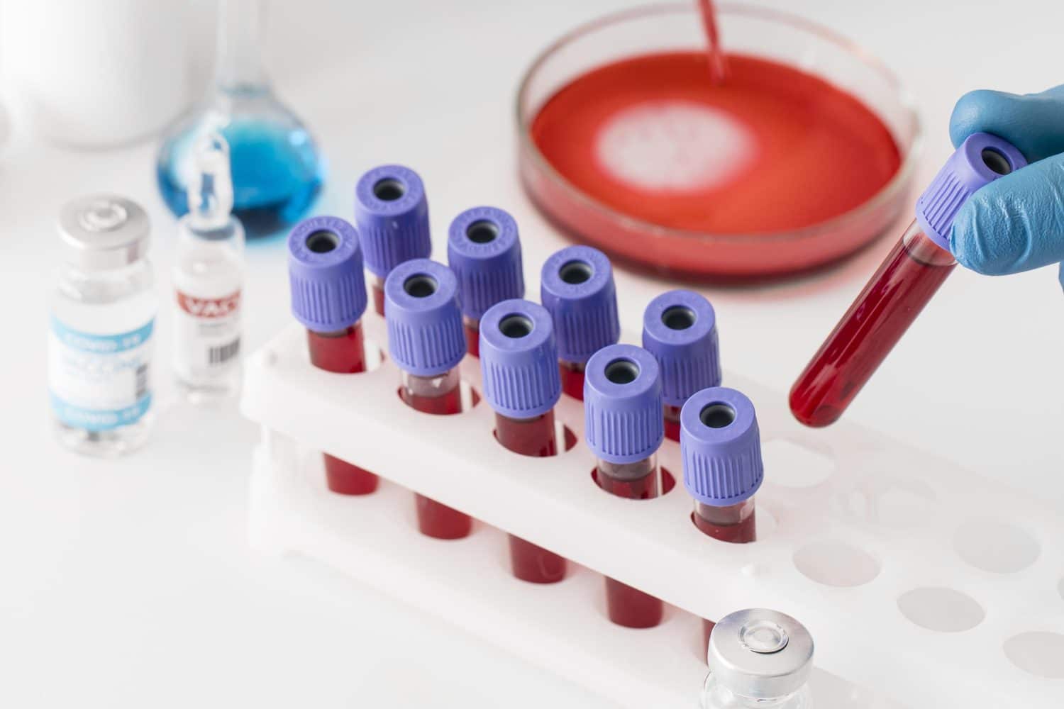 Grupo sanguíneo y personalidad por qué suena tan real