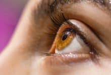 Heterocromía en famosos cuando tienen ojos de diferente color y por qué ocurre
