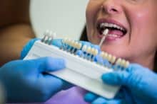 implantes dentales