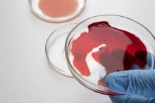 Microplásticos en su sangre